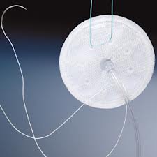 Biomesh CA.B.S. AIR Composite Prosthesis for Hernia from Cousin