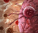 Novel immunotherapy targeting pancreatic cancer shows promising results in phase 1/2 trial