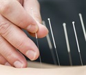 Acupuncture improves pain and function in older adults with chronic low back pain