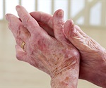 Process to minimize the side effect of painful arthritis