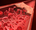 Extended use of anti-clotting drugs reduces risk of recurrent blood clots