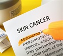 Researchers develop multiethnic model for identifying individuals with skin cancer