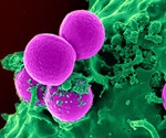 Researchers find way to kill cystic fibrosis superbug, Burkholderia cenocepacia