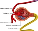 Focal Segmental Glomerular Sclerosis Diagnosis and Treatment