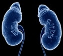 Stem cell treatment could help millions of people with end-stage kidney disease