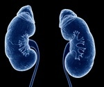 Web-based tool could aid in early detection and prevention of chronic kidney disease