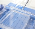 What is Polyacrylamide Gel Electrophoresis (PAGE)?