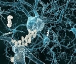 Researchers reveal common synaptic pathway behind Parkinson’s and Alzheimer’s diseases