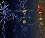 New European initiative aims to transform real world Alzheimer’s disease care