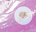 microDimensions releases upgraded version of free digital pathology viewer Zoom