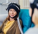 Scalp cooling provides safe, effective treatment in prevention of chemotherapy-induced alopecia