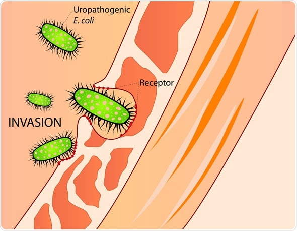 invasion of E. Coli - Image Copyright: mmzgombic / Shutterstock