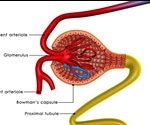 Glomerular Diseases