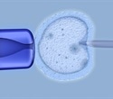 Maternal age drives embryo arrest independently of chromosomal errors