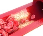 Novel nanomedicine mPEG@ELA-11 shows potential in treating atherosclerosis