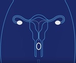 Long-Acting Reversible Contraception (LARC) Types
