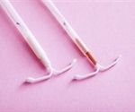 Intrauterine Device (IUD) and Intrauterine System (IUS) Differences