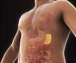 Symptoms and Causes of Enlarged Spleen (Splenomegaly)