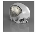 Surgeons to showcase Renishaw implant technology during masterclass at BAOMS conference