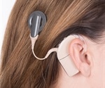 When a hearing aid isn’t enough