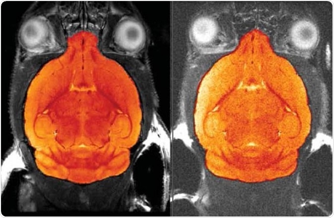 Comparison of 1H four channel phased array receive-only MRI CryoProbe with room temperature phased-array coil.