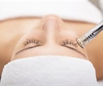 What is Microdermabrasion?
