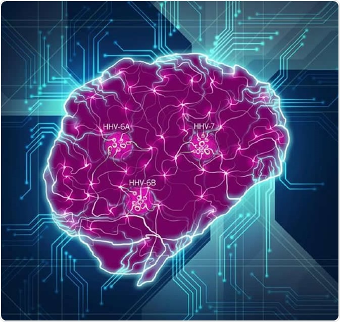 The brain is shown here as a complex network of interactions, with disruption of connections by the key viral species (HHV-6A, HHV-6B, HHV-7) identified in this study. Image Credit: Readhead et al.