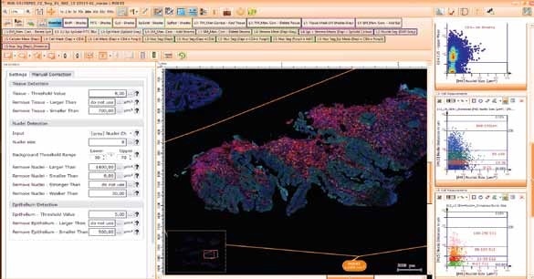 TissueGnostics’ award-winning software to analyze medical images creates the basis for the individualized medicine of the future, helping to organize millions of data points. (© TissueGnostics (2))