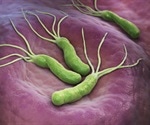 Parkinson's Disease and Helicobacter Pylori