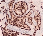 Immunohistochemistry (IHC) Imaging Techniques