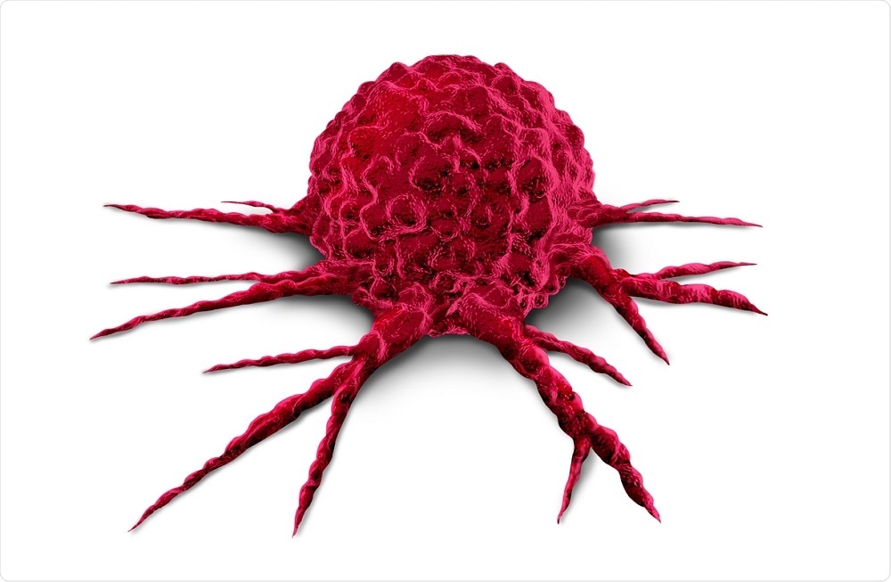 Cancer cell - lightspring on shutterstock