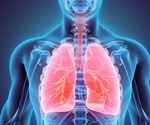 Chronic Obstructive Pulmonary Disease Treatment