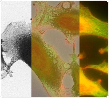 Correlated light and electron microscopy image of HeLa cells.