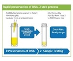 Stabilization of mRNA in Urine to Aid Diagnostic Tests for Prostate Cancer