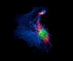 Structured Illumination Microscopy (SIM)