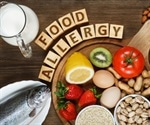 Researchers receive NPB grant to develop online food allergy support tool