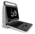 Sonologic's EBit60 Ultrasound Machine