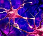 Mayo Clinic study reveals brain cell deficit behind Tourette syndrome