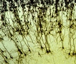 Researchers use "zap-and-freeze" technique to watch hard-to-see brain cell communications