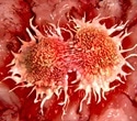 Individualized drug combinations improve cancer treatment outcomes