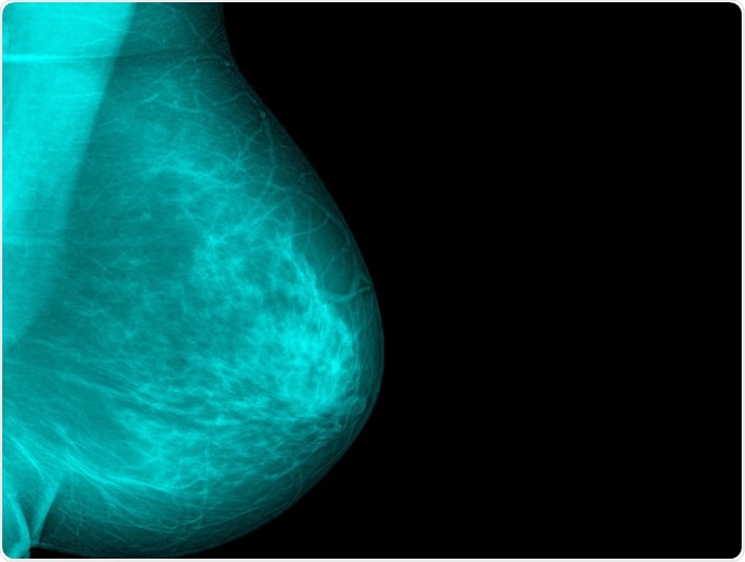 Photo of breast tissue