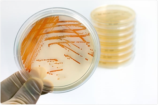Colonies of bacteria Streptococcus agalactiae in culture medium plate. Image Credit: Angellodeco / Shutterstock