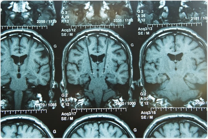 Image Credit: Image Point Fr / Shutterstock