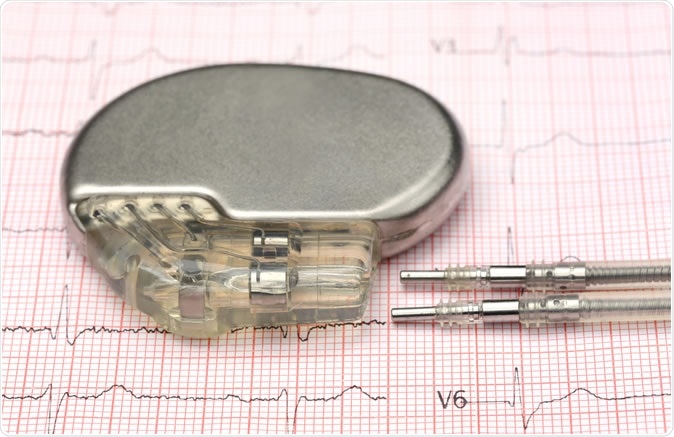 Close up of pacemaker on electrocardiograph. Image Credit: Swapan Photography / Shutterstock
