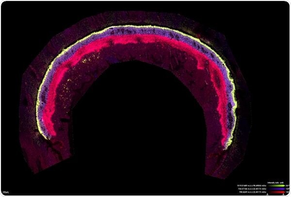 Mouse retina