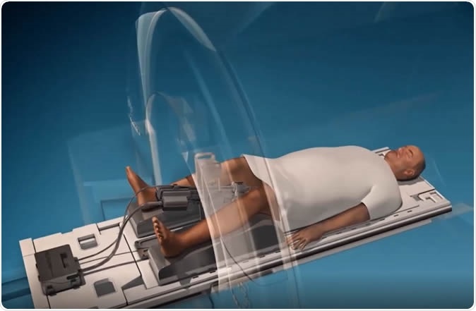 Pivotal Trial of MRI-Guided Transurethral Ultrasound Ablation (TULSA) in Patients with Localized Prostate Cancer. Image Credit: RSNA