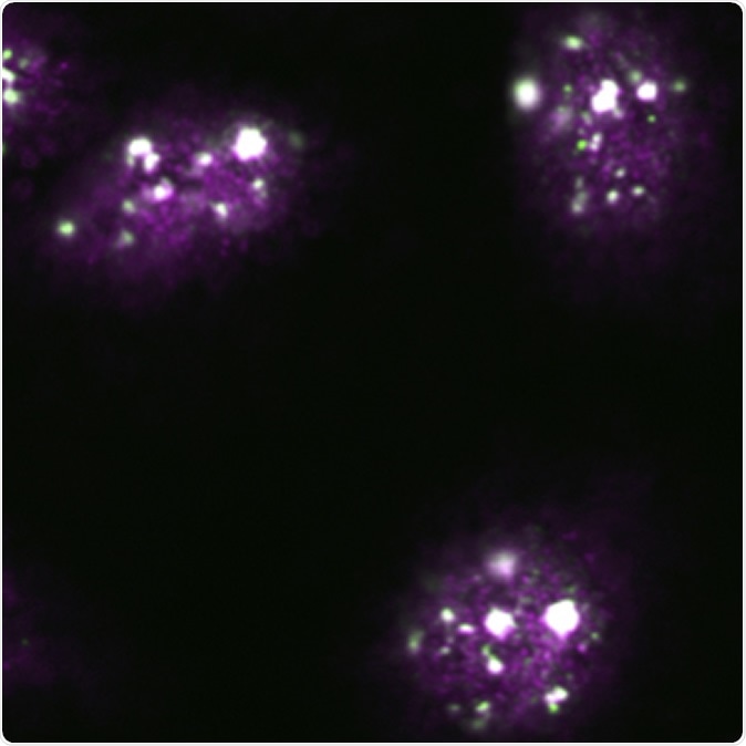 Nuclear stress bodies (white) formed in response to heat stress. Image Credit: Hokkaido University
