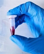 Quality Control for Biobanks Using NMR (Research Use Only)