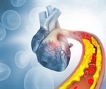 Early cholesterol checks could save your heart
