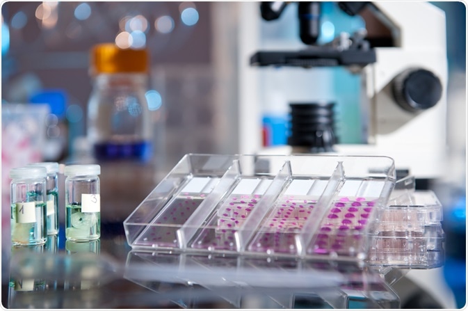 immunohistochemistry